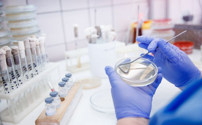 hands in a lab with specimens